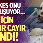Kızı için cayır cayır yandı!