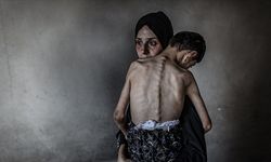 Gazze'de son 24 saatte 5 kişi daha açlıktan hayatını kaybetti