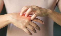 "Kış aylarında görülen deri hastalıklarına dikkat!"