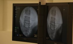 Fıtıkla uzun süre yaşamak ciddi risklere neden olabiliyor!