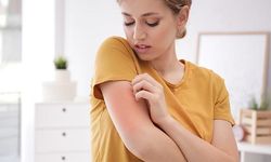 Türk Dermatoloji Derneği’nden ‘Uyuz’ açıklaması