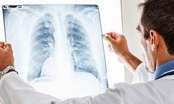 Solunum yolu enfeksiyonu zatürre gelişimine neden olabiliyor