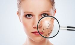 Cilt yenilemede fraksiyonel karbondioksit lazer yöntemi