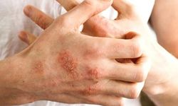 Çocuklarda bu belirtilere dikkat!