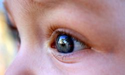Çocuklarda göz tembelliğine dikkat!
