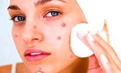 Sosyal medya trendleri cildi yaşlandırıyor