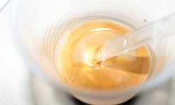 Şekerli içecekler gençlerde kaygı riskini artırabilir