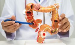 Yüksek kalorili beslenmek kolon kanseri sebebi olabilir