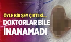 Yemek borusundan çıkan şey doktorları bile şoke etti