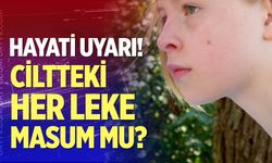 Bu Belirtileri Görüyorsanız Geç Kalmayın!