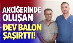 Akciğerinde oluşan dev balon şaşırttı!