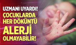 Çocuklarda görülen her döküntü alerji olmayabilir!