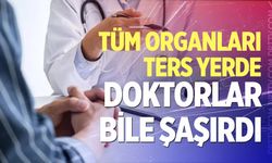 Tüm organları ters yerde: Doktorlar bile şaşırdı