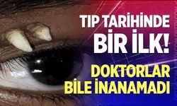 Tıp tarihinde bir ilk!