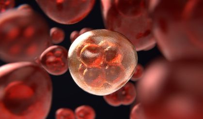 Kalın bağırsak kanserinde erken tanı ve tedavinin önemi