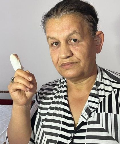 İzmir’de pitbull saldırısı: 5 çocuk annesi kadının parmağı koptu