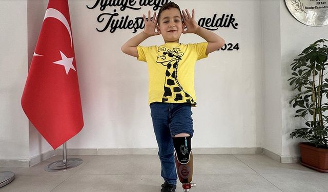 Depremde kaybettiği bacağı için Galatasaray armalı protez yapıldı
