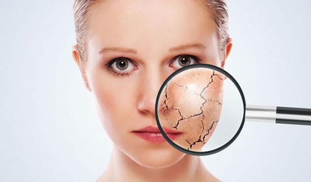 "Kışın düşen D vitamini, cilt hastalıklarını alevlendiriyor"