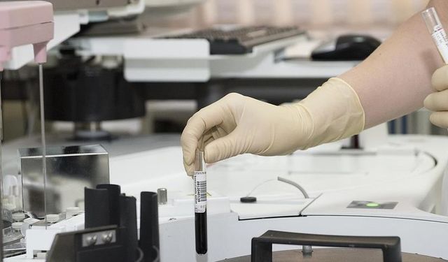 Vücutta gizlenen tümör, "immünoterapi" ile yok ediliyor