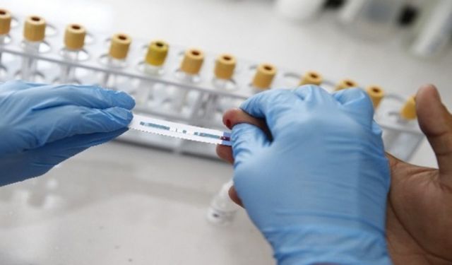 "HIV, tüm yaş gruplarında enfeksiyona neden olan bir virüstür"