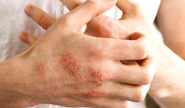 Çocuklarda bu belirtilere dikkat!