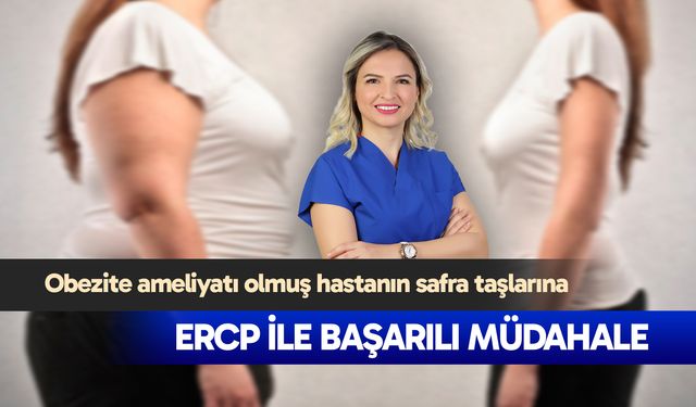 Obezite ameliyatı olmuş hastanın safra taşlarına ERCP ile başarılı müdahale