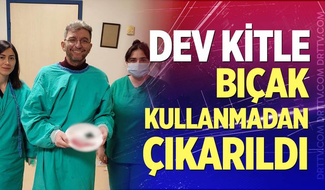 Kalın Bağırsaktaki Kitle Ameliyatsız Yöntemle Çıkarıldı