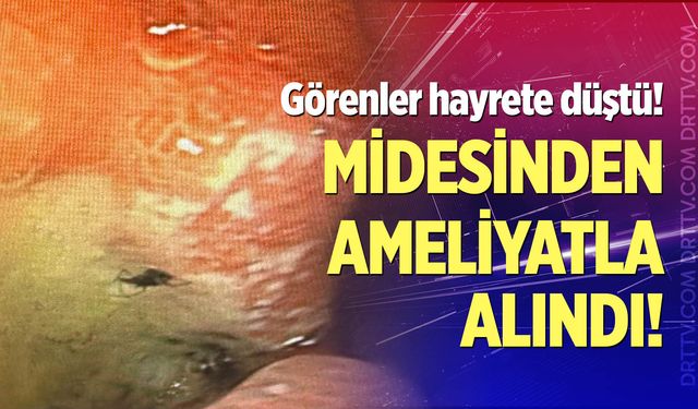 İlginç ama gerçek!