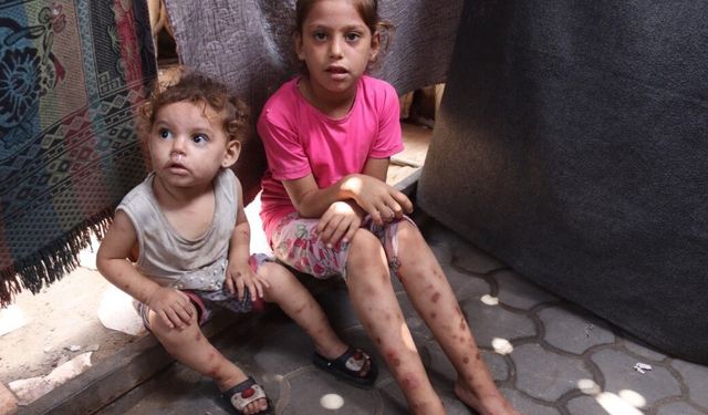 Gazze'de suçiçeği alarmı: Vakalar iki haftada 9 bini aştı