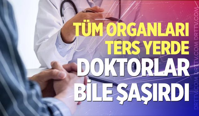 Tüm organları ters yerde: Doktorlar bile şaşırdı