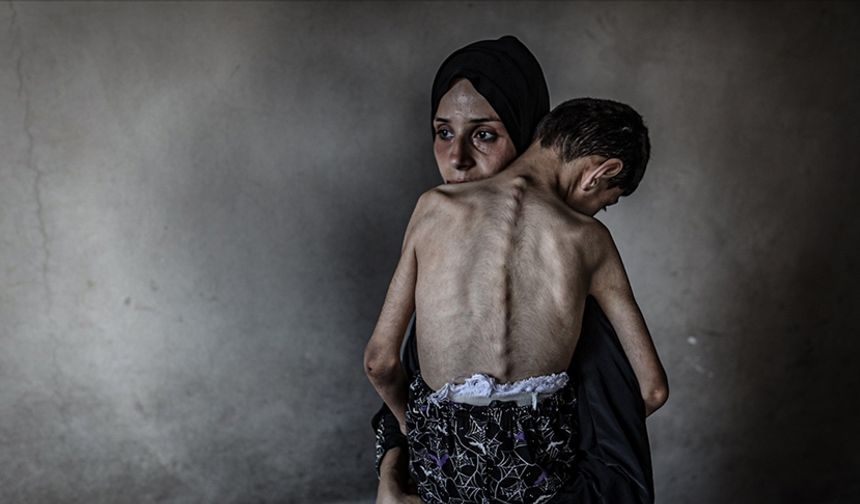 Gazze'de son 24 saatte 5 kişi daha açlıktan hayatını kaybetti