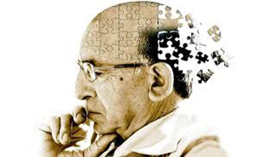 Uzmanından Alzheimer uyarısı