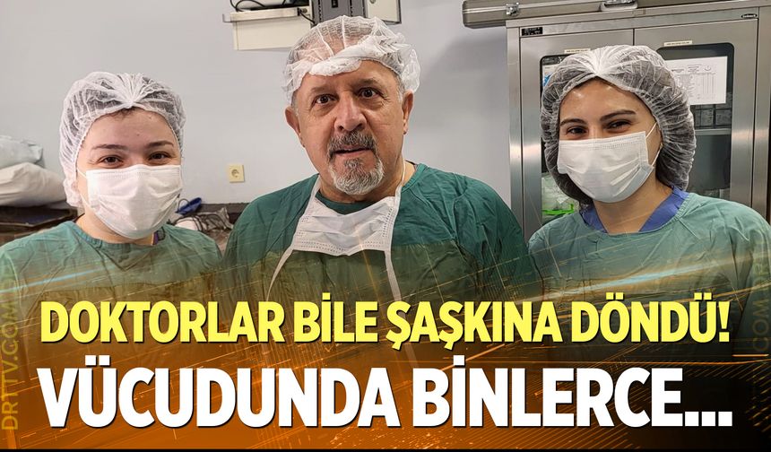 Doktorlar şaşkına döndü! Karın ağrısıyla gitti, safrasından binlerce taş çıktı...