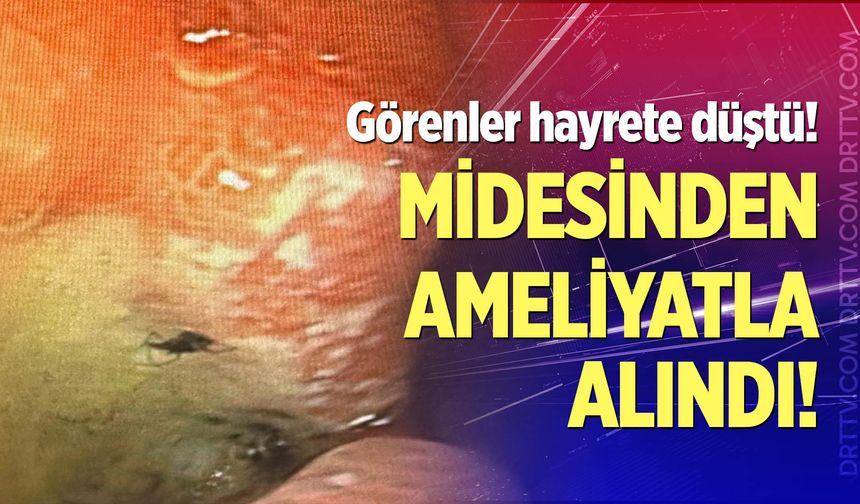 İlginç ama gerçek!