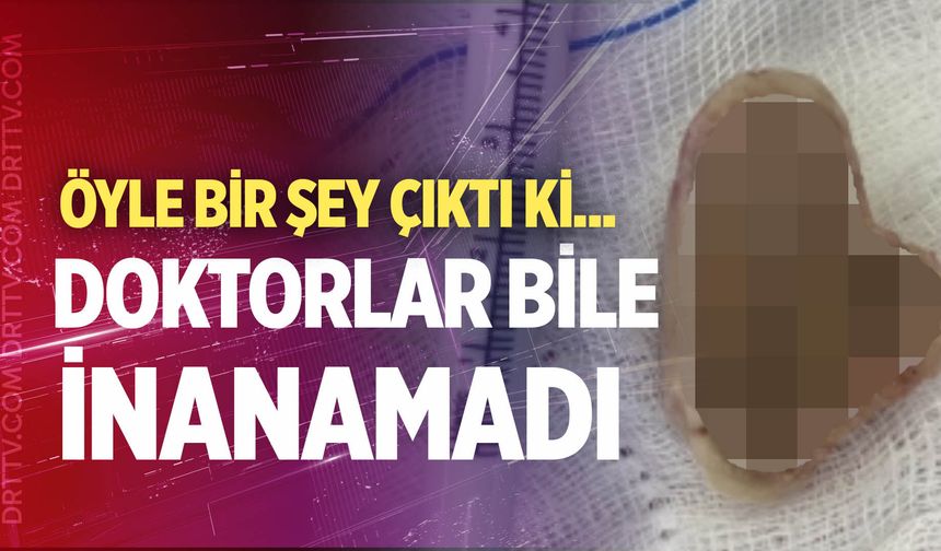 Yemek borusundan çıkan şey doktorları bile şoke etti
