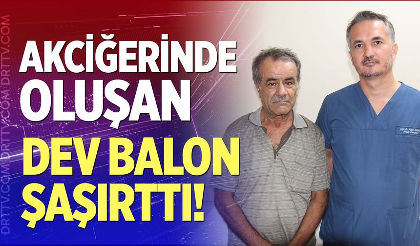 Akciğerinde oluşan dev balon şaşırttı!