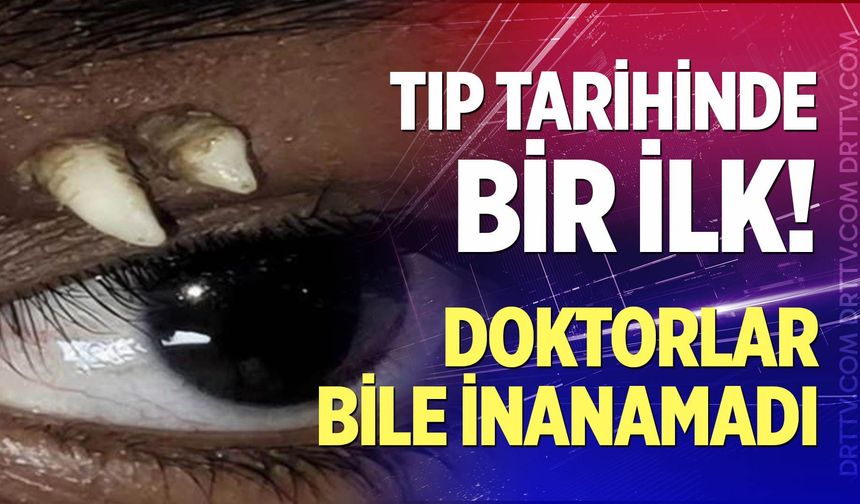 Tıp tarihinde bir ilk!