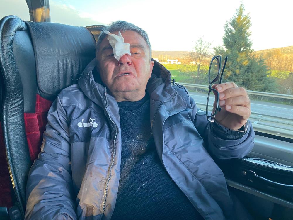 Takım Otobüsüne Taşlı Saldırıda Sportif Direktör Yaralandı