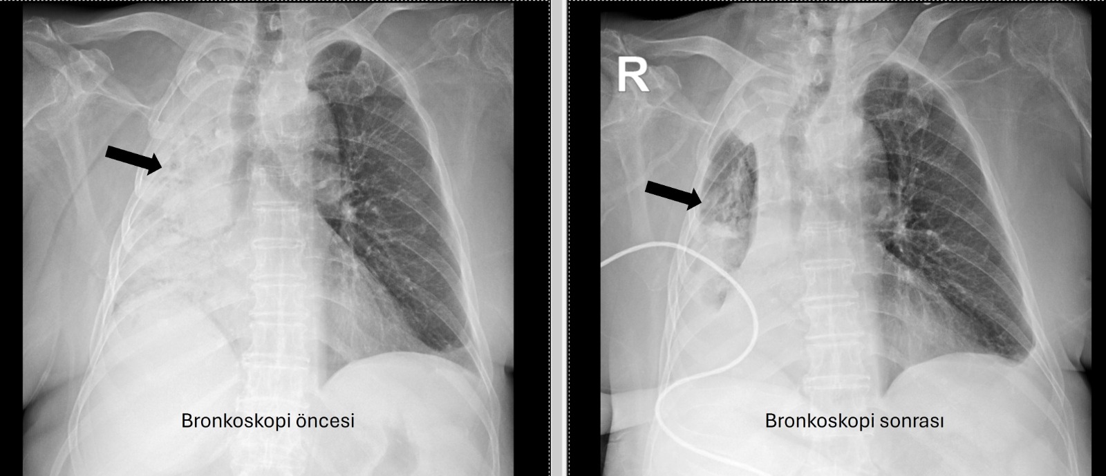 Denizli Haber Mısır (1)