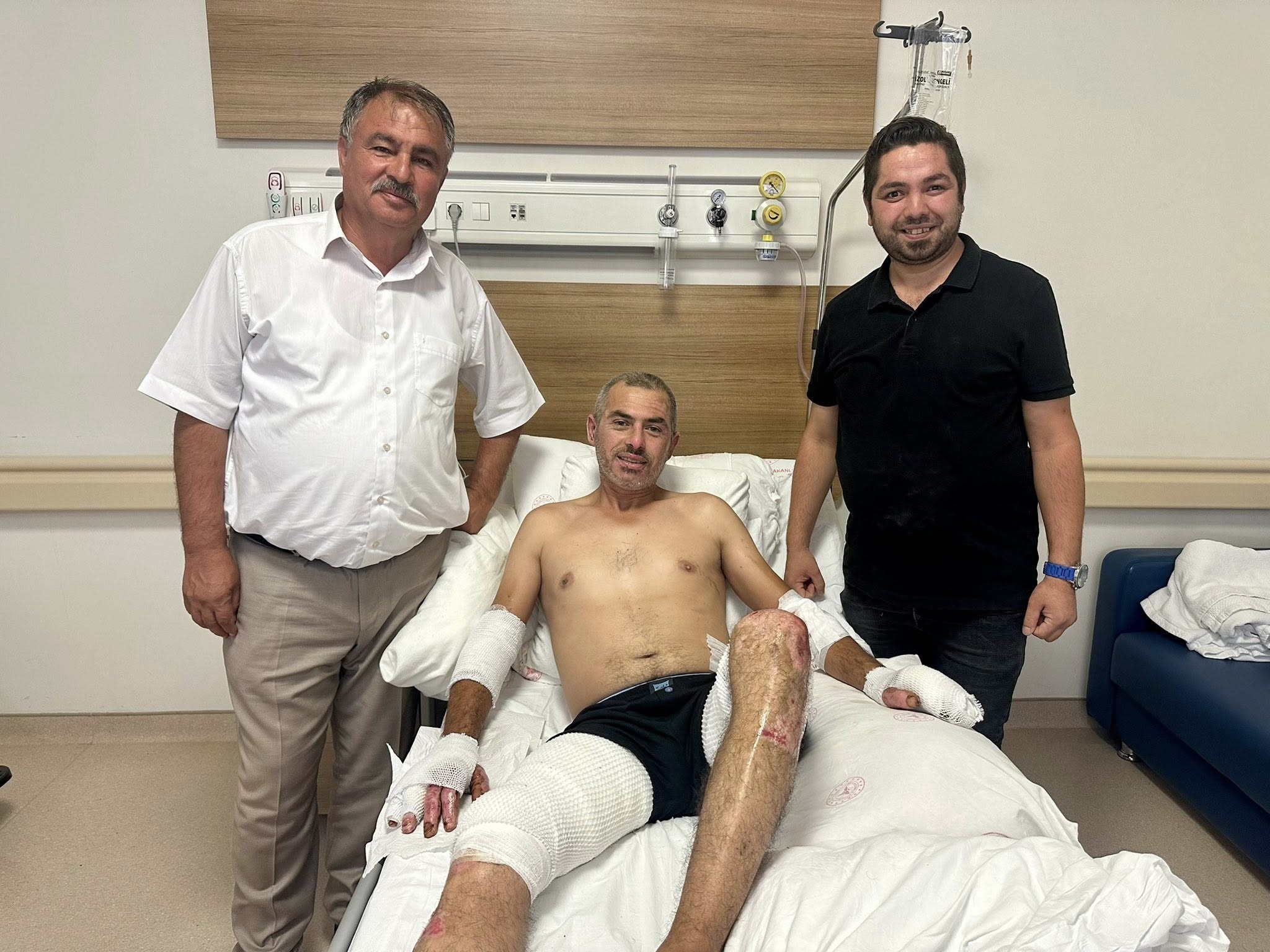 Denizli Haber Başkan Yangın Yaralı