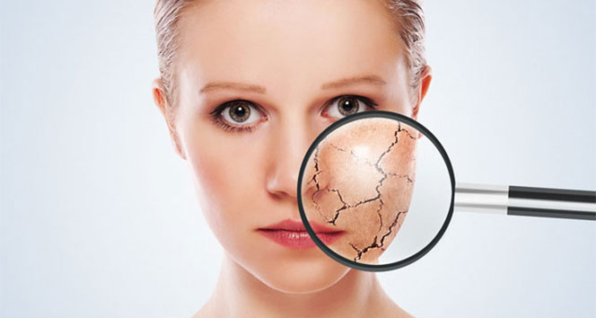 Denizli Haber Cilhastalığı