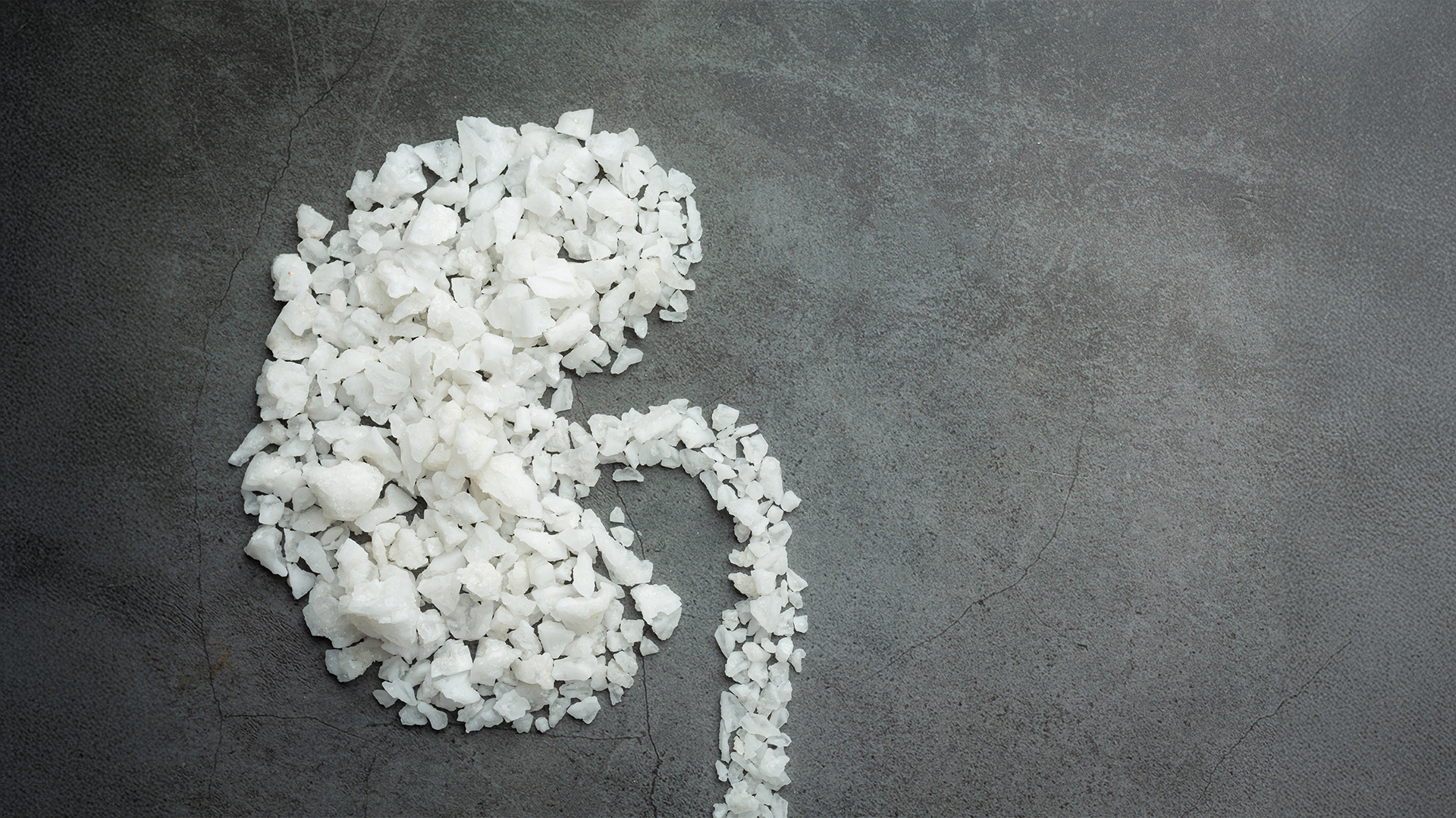 Denizli Haber Böbrek Taşı Gürağaç (3)