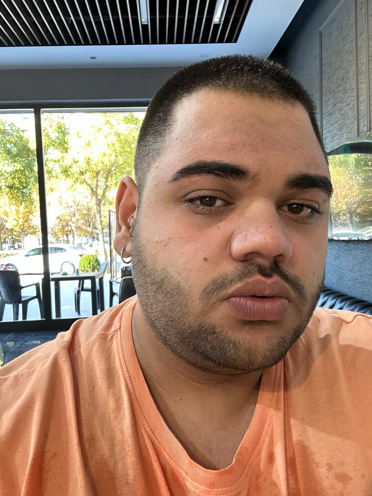 Tüp Mide Operasyonu Geçiren Genç 170 Kilodan 95'E Düştü.. (4)