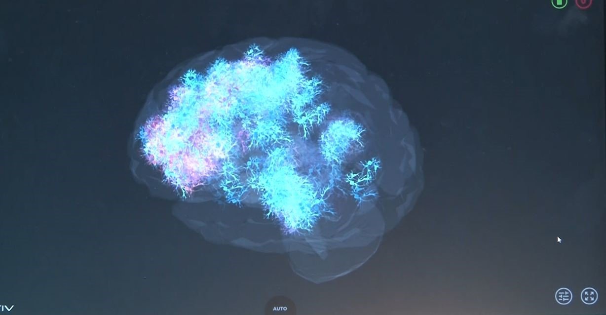 Denizli Haber Nörop